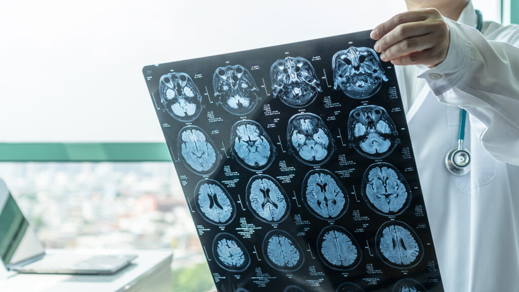 Médico olhando um resultado de exame de ressonância magnética de crânio