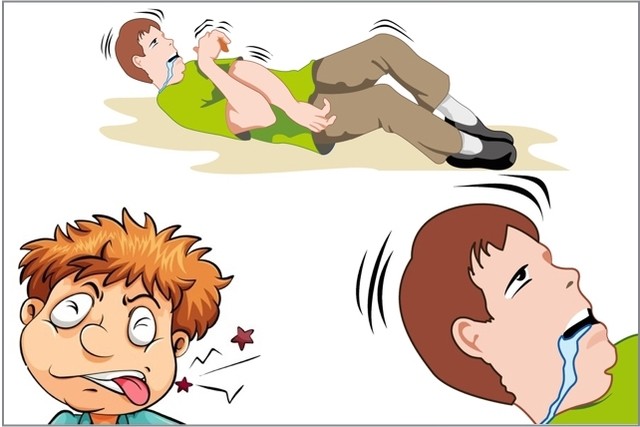 Imagem mostrando uma convulsão com os sinais comuns