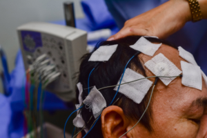 Imagem que mostra um homem fazendo eletroencefalograma