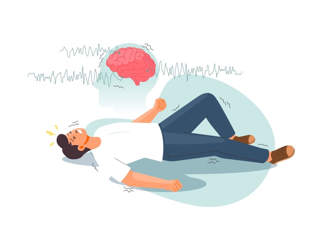 Imagem de um homem convulsionando e, acima, um cérebro com descargas epilépticas