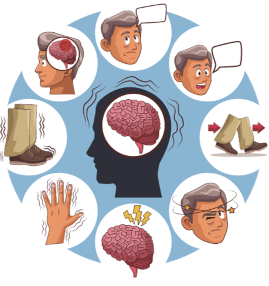 Imagem dos sintomas de Lewy