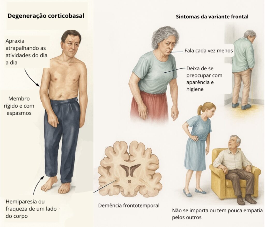 Sintomas do paciente com Degeneração corticobasal