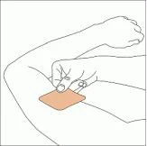 Adesivo de rotigotina sendo aplicado no braço