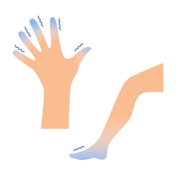 Pé e mão cianóticos por alteração da circulação